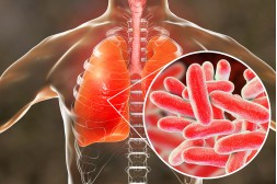 Zapobieganie legionelli w domu Zapobieganie legionelli w domu